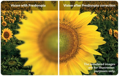 Understanding Presbyopia | PanOptix