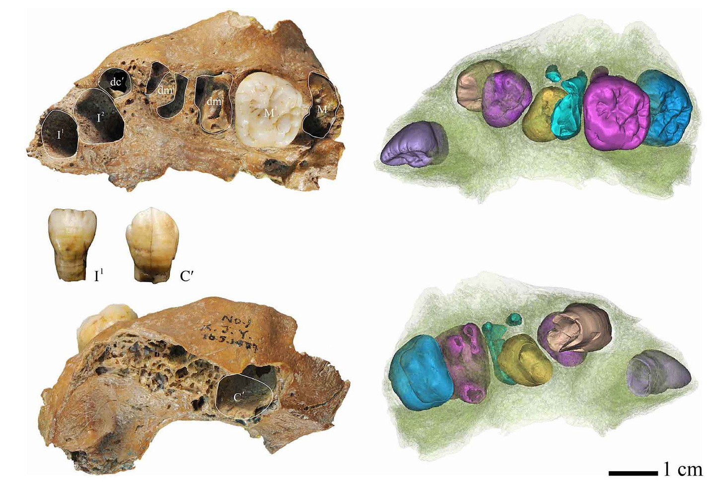 A fossil child's upper jaw with teeth, in two views on left and two angles of microCT on the right
