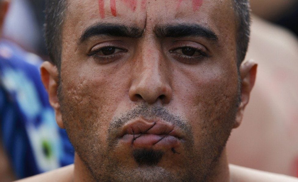 Migrant crisis: 'Iranians' sew lips shut in border protest - BBC News