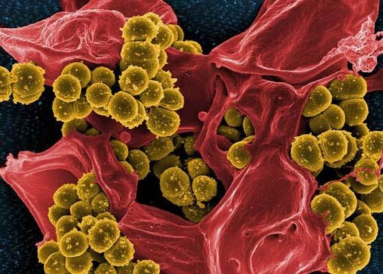 bacteria close-up