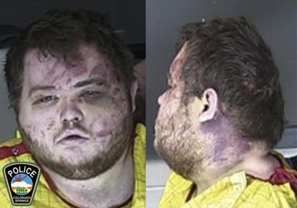 FILE - This booking photo provided by the Colorado Springs, Colo., Police Department shows Anderson Lee Aldrich. (Colorado Springs Police Department via AP, File)