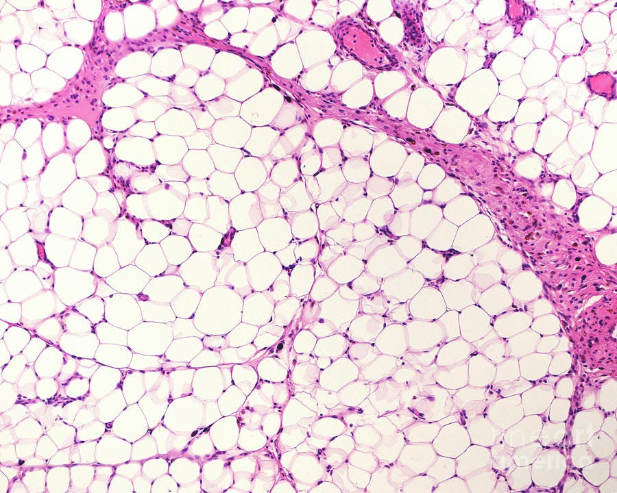 White Adipose Tissue #1 by Science Photo Library
