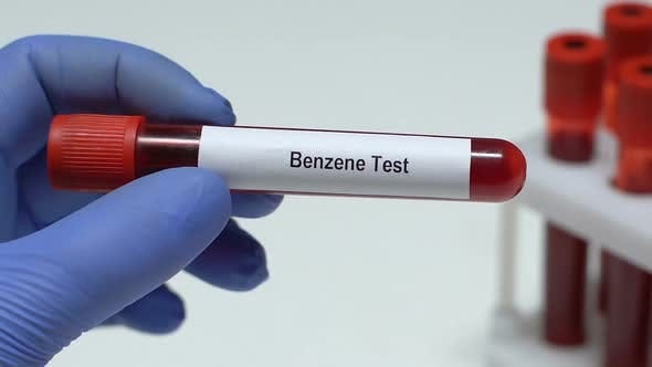 Benzene Test, Doctor Holding Blood Sample in Tube Close-Up, Health  Check-Up, Medical Stock Footage ft. awareness & cancer - Envato Elements