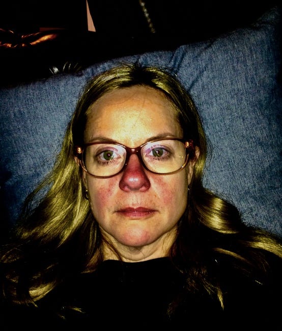A blonde woman wearing glasses and a red, blotchy face lays against a blue pillow looking sad.