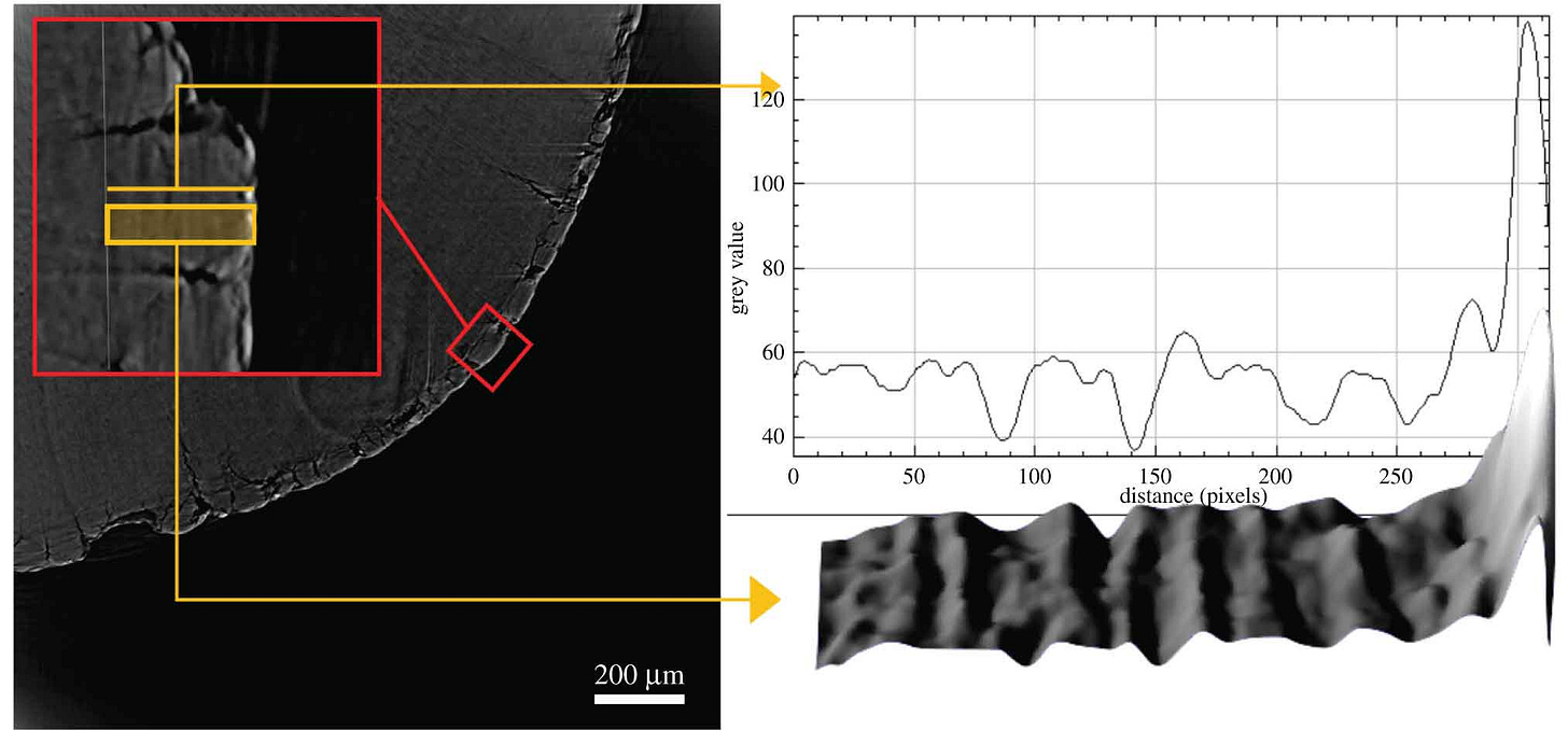 A micrograph showing the tooth root section with cementum in expanded pane, on the right a readout of relative density with peaks and troughs. A micrograph showing the tooth root section with cementum in expanded pane, on the right a readout of relative density with peaks and troughs.
