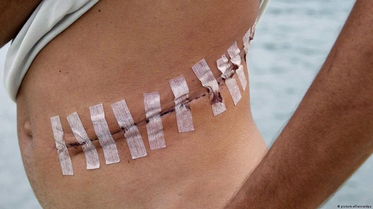 Israeli behind organ trafficking ring is arrested – DW – 01/06/2018