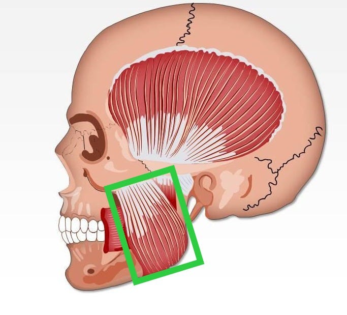 0714 Masseter Muscle Medical Images For PowerPoint | PowerPoint Shapes |  PowerPoint Slide Deck Template | Presentation Visual Aids | Slide PPT