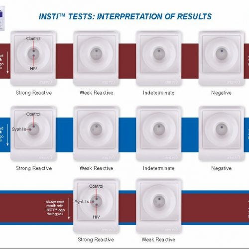 test HIV e sifilide: diversi tipi di risultato