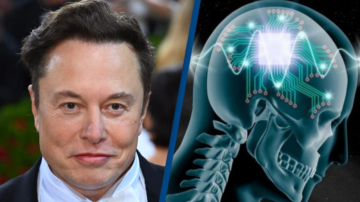 Elon Musk Believes His Neuralink Brain Chips May Cure Illness One-In-Three  People Have