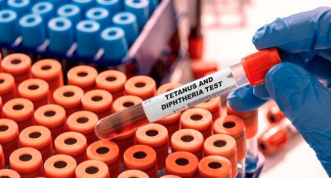 Tetanus and diphtheria blood test