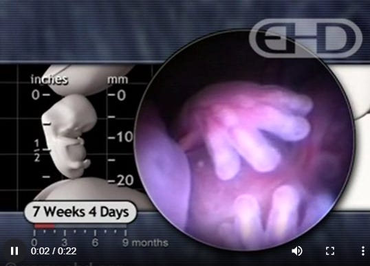 fetal tissue- baby in womb