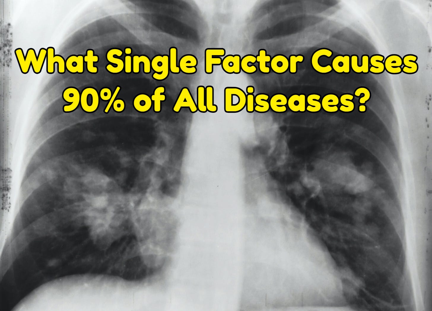 What Single Factor Causes 90% of All Diseases?