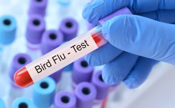 doctor holding a test blood sample tube with bird flu test on the background of medical test tubes with analyzes. - birdflu bildbanksfoton och bilder