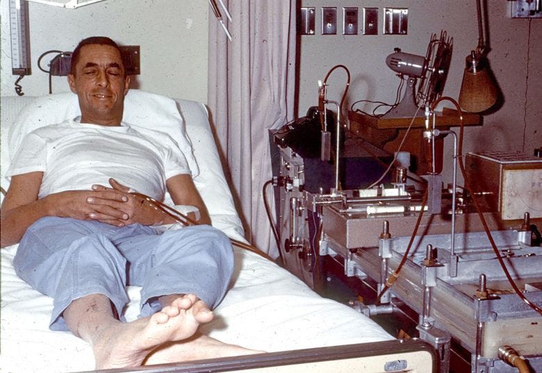 THEN: Clyde Shields receives dialysis at the University of Washington Hospital. Invention of the “Scribner shunt” gave hope to patients suffering from renal failure. Dr. Belding Scribner affectionately nicknamed Shields “Number One.” (Courtesy Northwest Kidney Centers)