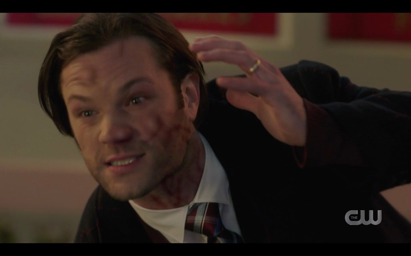 Sam Winchester with distorted blotchy face spn 1415