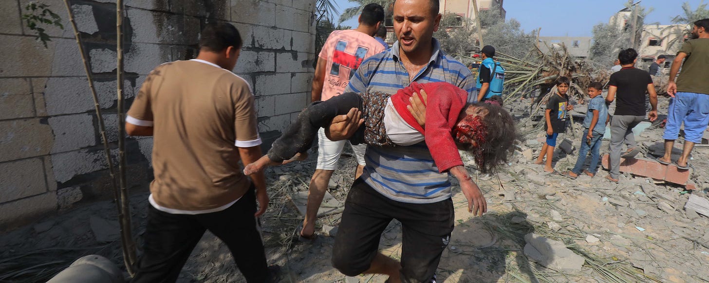 A man carries a young girl with a major injury to her face while walking across road filled with debris