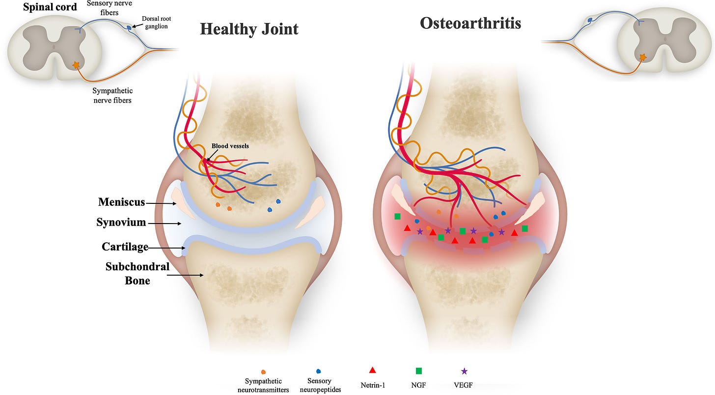 Frontiers | Cutting-Edge Technologies for Inflamed Joints on Chip: How  Close Are We?