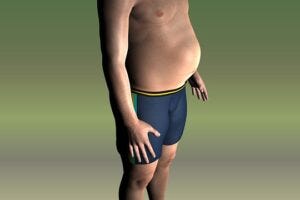 Obese man illustration from Pixabay
