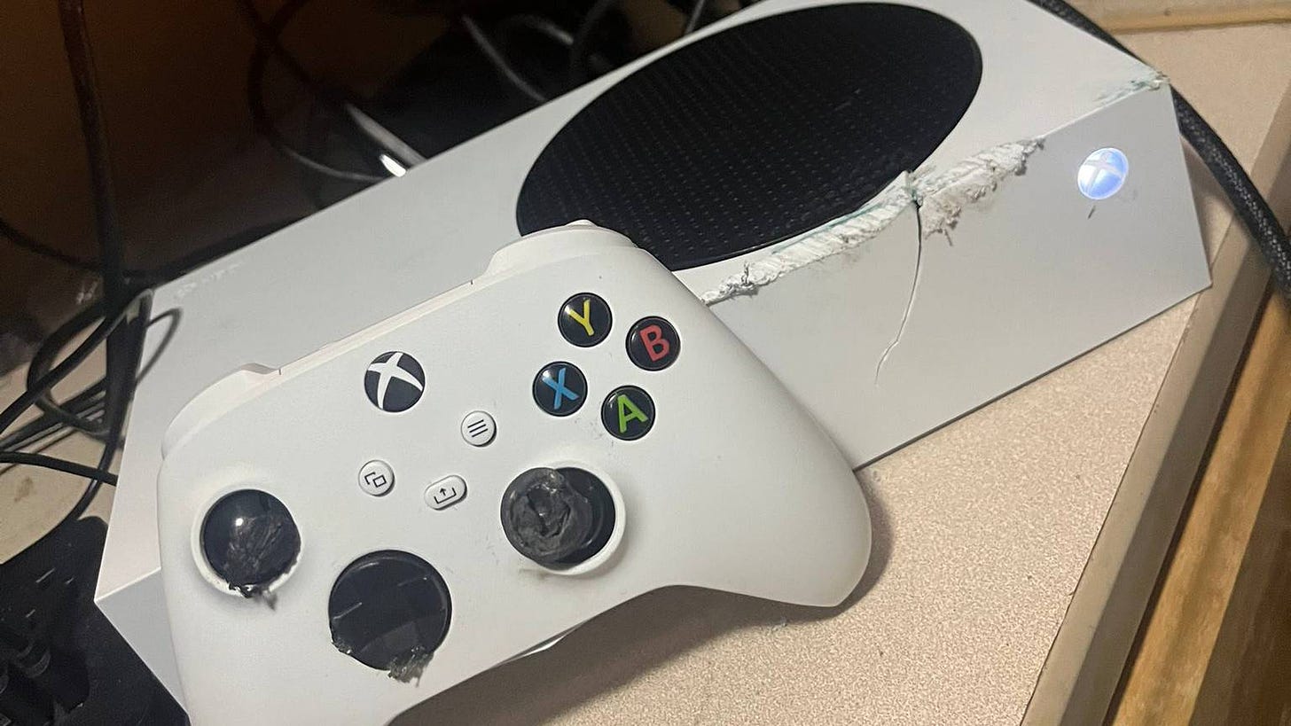 Xbox Series S saves man's life