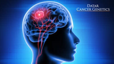 Blood Test to Help Diagnose Inaccessible Brain Tumors (PRNewsfoto/Datar Cancer Genetics)
