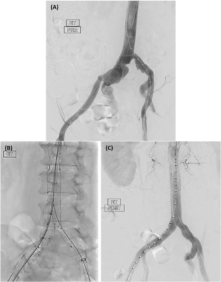 Fig 4