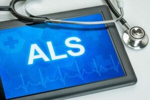 New research led by scientists at OHSU reveal that modulating immune cells may slow the progression of amyotrophic lateral sclerosis, or ALS, a fatal neurodegenerative disease. (Getty Images)