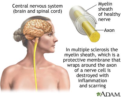 Multiple sclerosis: MedlinePlus Medical Encyclopedia
