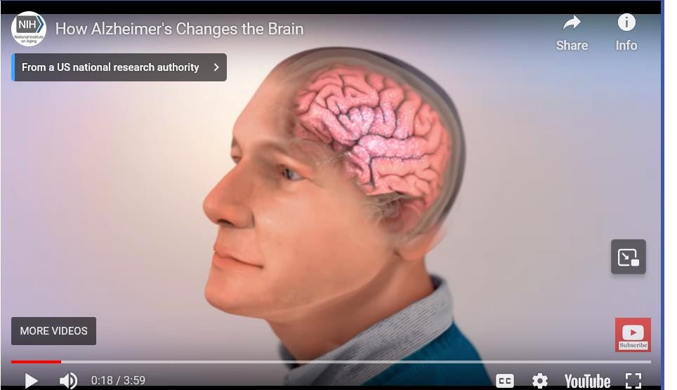 Video from NIH National Institute on Aging: How Alzheimer's Changes the Brain