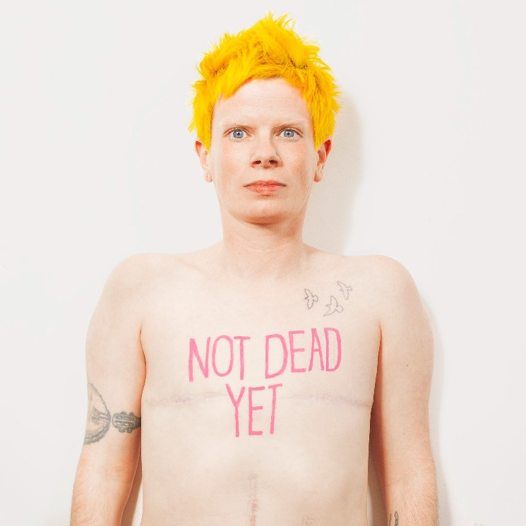 A white person with short, bright-yellow hair is looking at us with a severe, wide-eyed face. They have visible scars running up and sideways across their chest. Tattoos. And the words NOT DEAD YET in pink, hand-drawn letters in the middle of their chest.