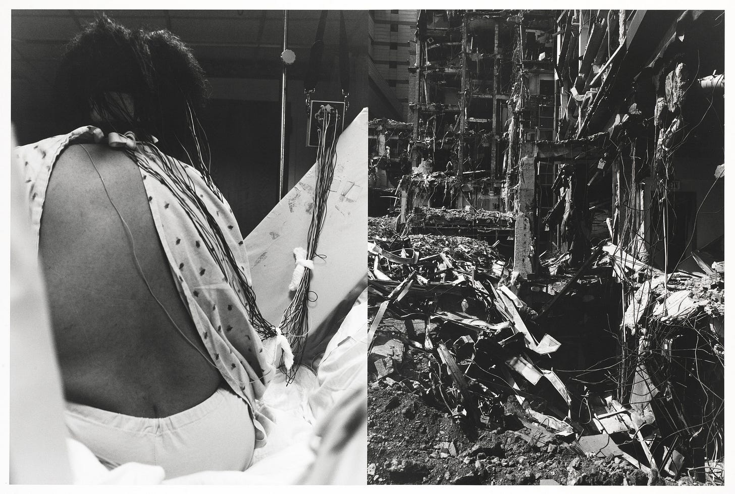 Two photos juxtaposed side by side in one frame. On the left is a photo of a black back wearing a hospital gown with wires connected to the body. In the photo on the right is an image of a demolished building.