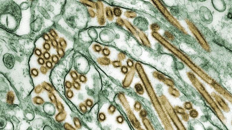 A person who worked on a dairy farm and had “direct contact with dairy cattle” tested positive for bird flu in Texas, according to state health officials.