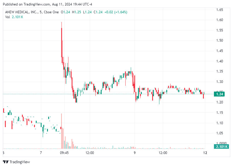 TradingView chart