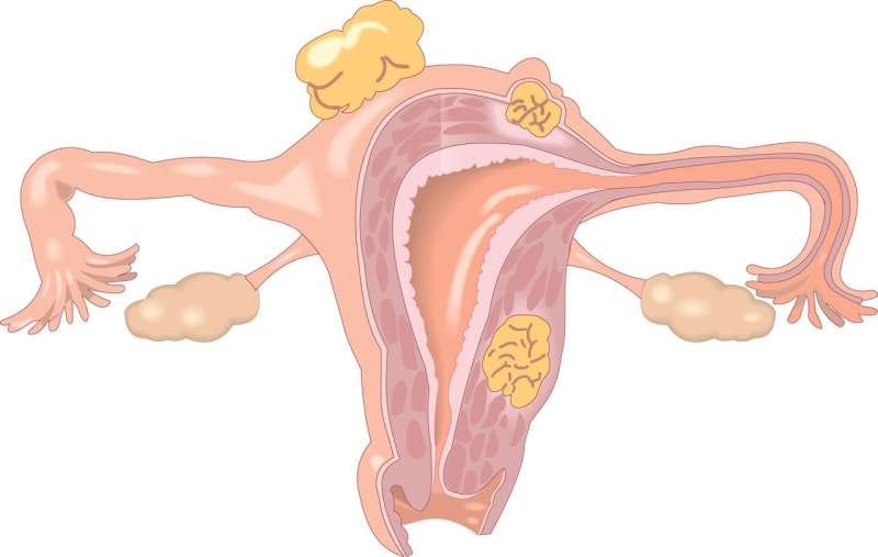 ovary