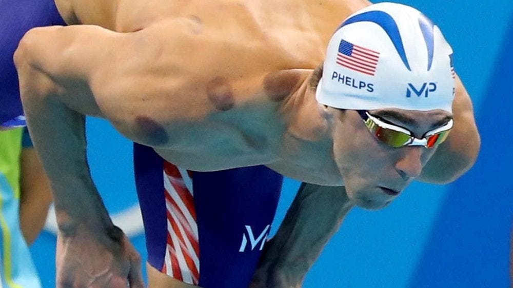 Michael Phelps brings ancient cupping to Rio Olympics 2016 images