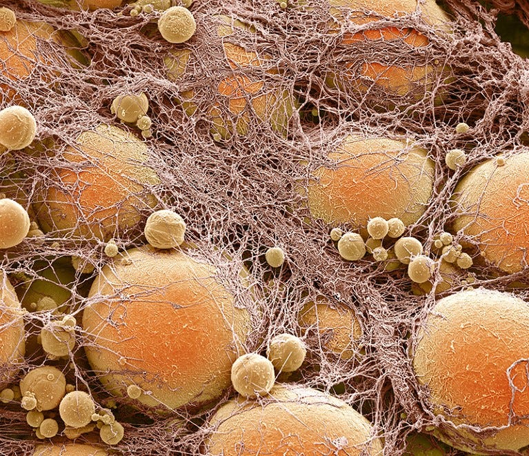 Coloured scanning electron micrograph (SEM) of joined fat-storing cells (adipocytes is orange).