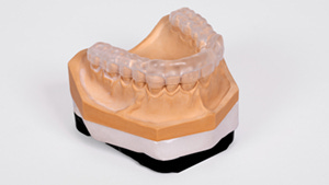 Occlusal splints: Innovation in dental technology