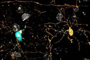A living-tissue model developed by Dartmouth researchers showed that a fatal trauma killed younger oligodendrocytes (blue) within 24 hours, while mature cells (yellow) took 45 days to die.