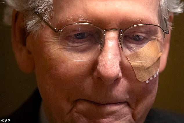 Senate Minority Leader Mitch McConnell of Ky. wore a bandage on his face as he walked to cast a vote on the Senate floor after falling during a luncheon on Capitol Hill on Dec. 10