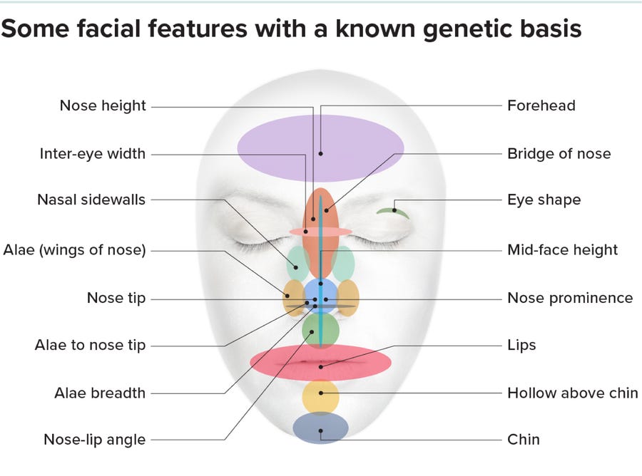 Graphic shows two overlapping 3D contour models of faces shown in side-view with labels highlighting features that make each one more or less PRS-like.