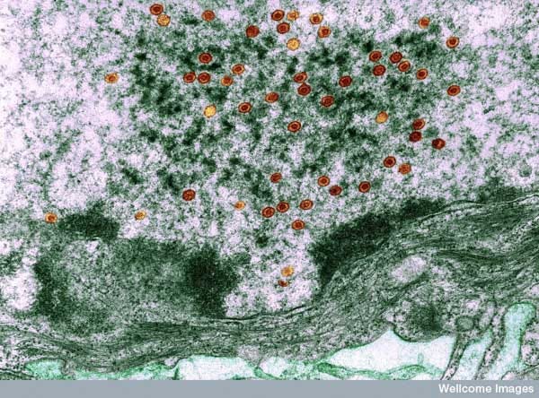 Herpes simplex viruses in cell nucleus, Wellcome Images CC-BY