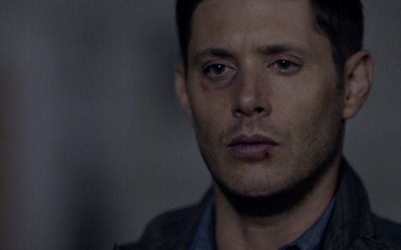 dean winchester beaten and brusied on supernatural 1301