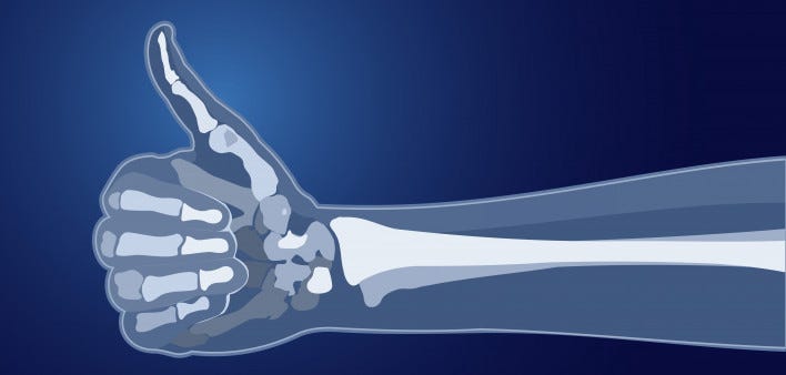 Cancer Health Basics: Maintaining Bone Health - Cancer Health