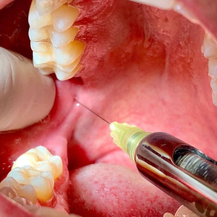 ID block | Dental treatment, Dental health, Happy dental