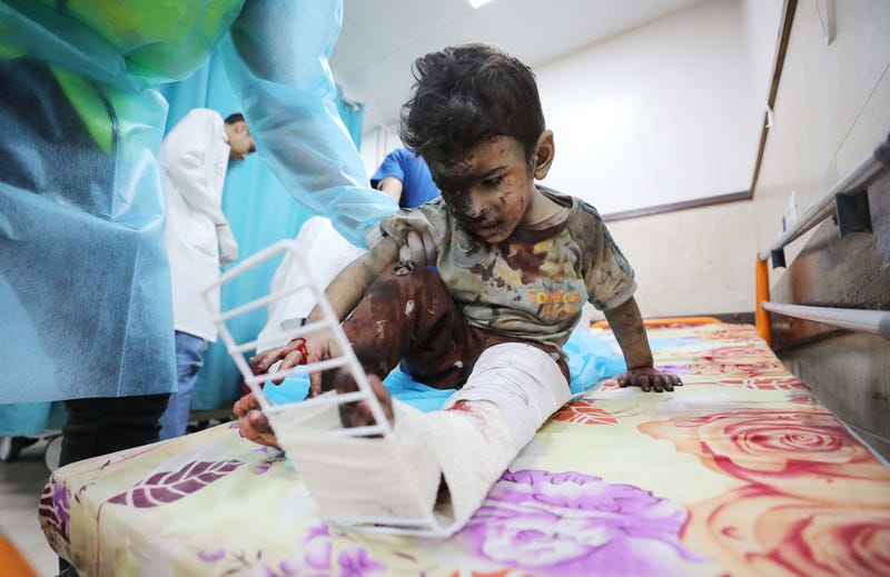 A bloodied young boy with black soot on one side of his face has a splint on his leg as he sits on a hospital bed and an adult wearing protective clothing holds his arm