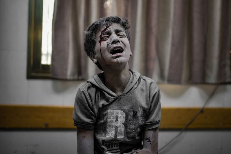 An injured boy cries at a hospital as the Israeli attacks continue on its 32nd day in Deir Al-Balah, Gaza.