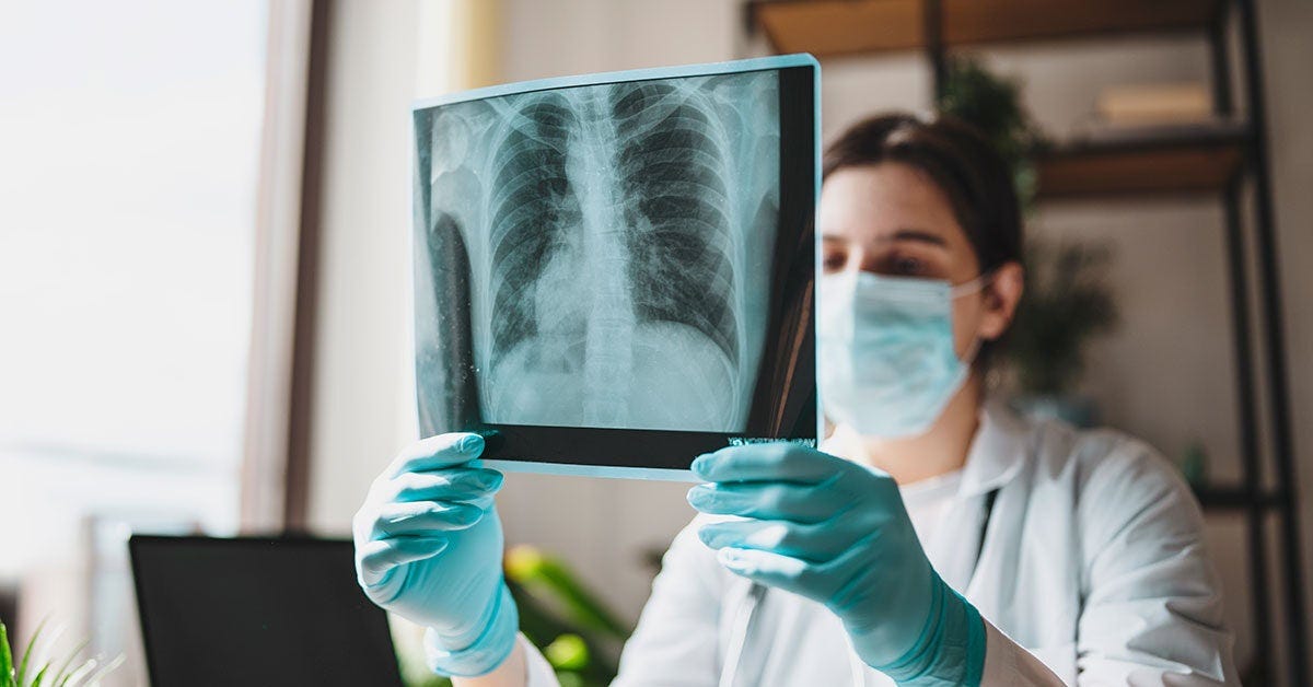 Non-Small Cell Lung Cancer: X-Ray Procedure, Info, and Risks