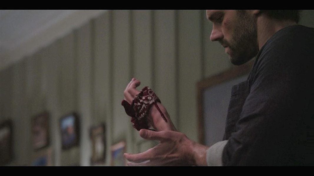 Jared Padalecki watching his hand bleed hard on Walker set.