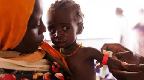 Getty Images Children are give a MUAC, (mid-upper arm circumference) test, to screen for signs of malnutrition inside the Médecins Sans Frontières, (MSF) clinic at the refugee transit camp on April 25, 2024 in Adre, Chad.