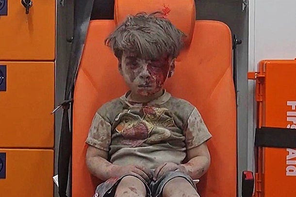 Foto de garotinho coberto de lama, poeira e sangue, sentado em cadeira de ambulância ou primeiros socorros.