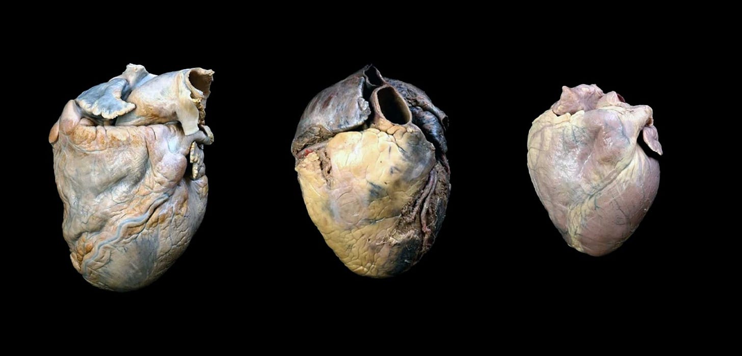 Hearts of an adult male gorilla, adult male human, and adult male chimpanzee Hearts of an adult male gorilla, adult male human, and adult male chimpanzee